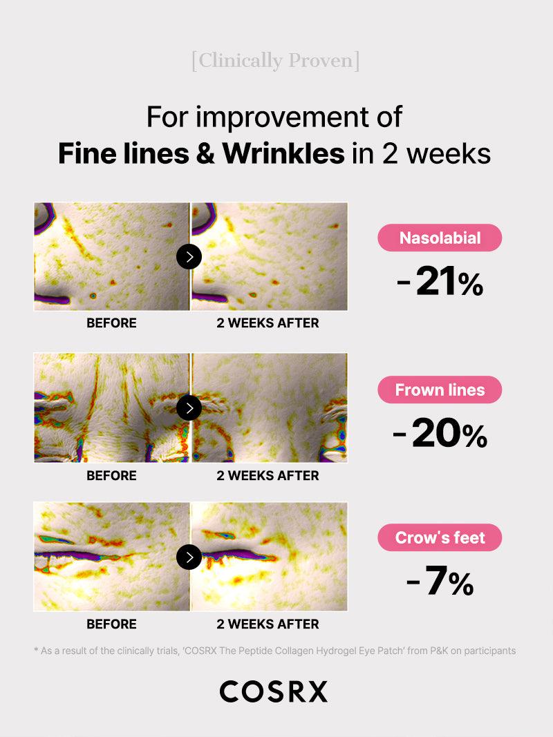 Zivetta Collagen Hydrogel Eye Patch