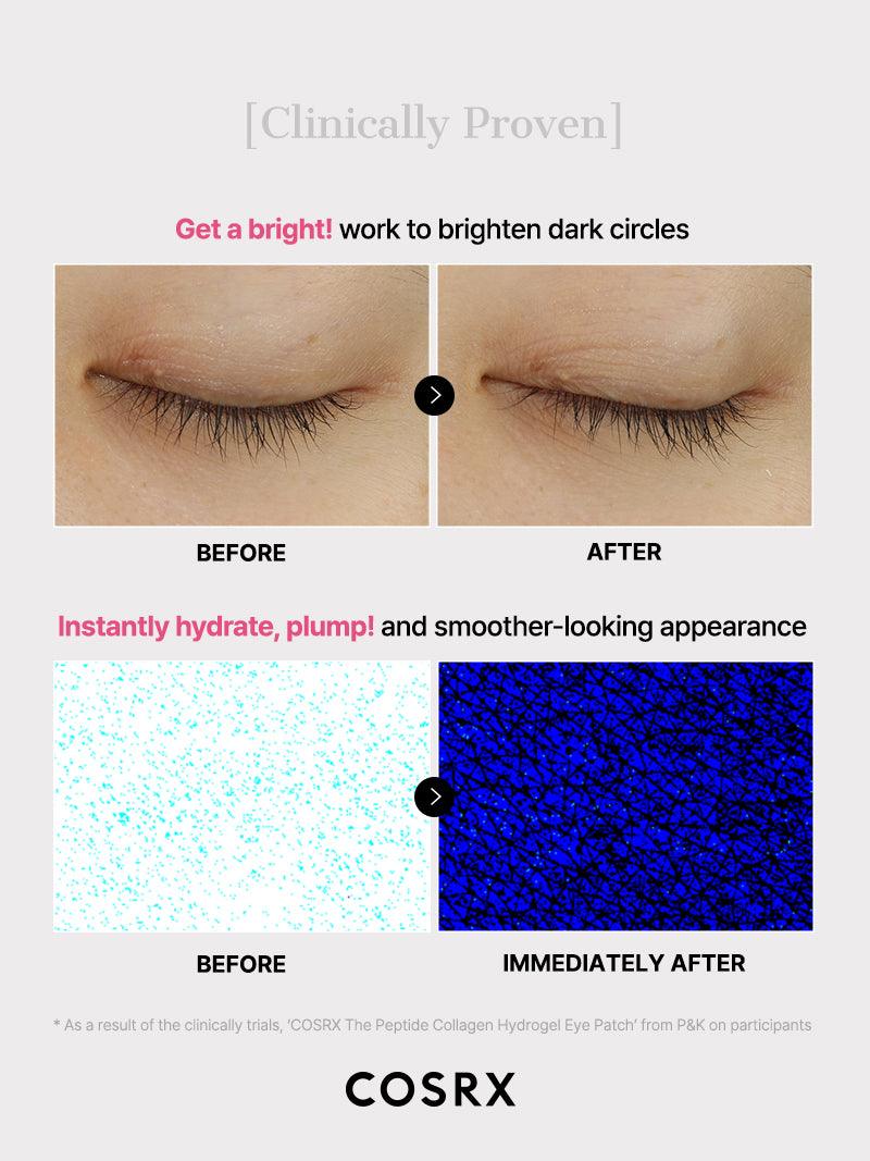 Zivetta Collagen Hydrogel Eye Patch